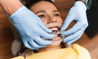 Orthodontist placing clear aligner on patient